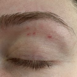 Eyebrow Threading By Priya - Ripped my eyelid skin in 4 places so badly it scabbed over