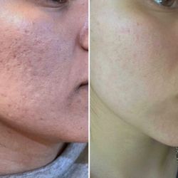 Natalie's Skin Solutions