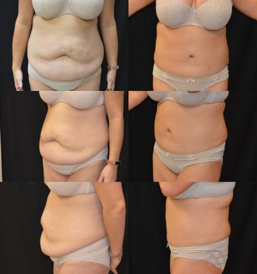 Baroody Plastic Surgery by null