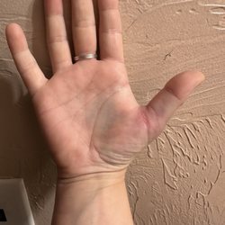 Police Dept - This is also a month after having my ass kicked by officer O. Garcia. It hurts. Still. A month later.