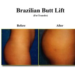 Rosenfeld Plastic Surgery
