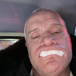 Brisman Implant and Oral Surgery - ONE OF THE 6 SURGERIES I HAD TO SUFFER THROUGH