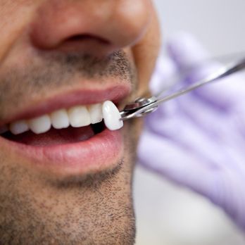 1. Gulch Cosmetic Dentistry