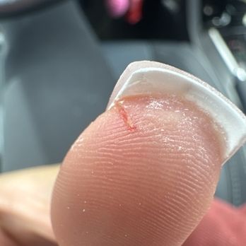 Venice Nail Spa Co - my cut thumb - Day Spas Near Me - Golden, Colorado