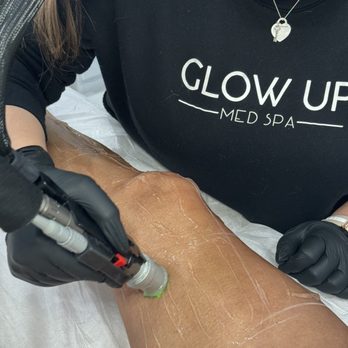 Glow Up Med Spa - Painless Hair Removal - Medical Spas Near Me - Santa Ana, California