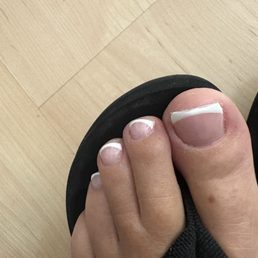 She had to fix my big toe with acrylic as is broke and was too short. She had to fix my big toe with acrylic as is broke and was too short.