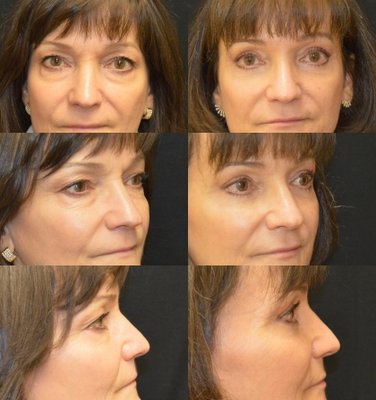 Baroody Plastic Surgery by null