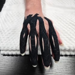 Norman Physical Therapy - Custom Splint