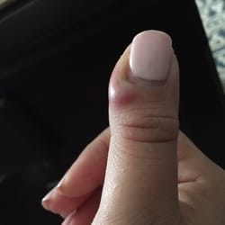 Tiffany's Nail Salon - Infection after a manucure at this place!