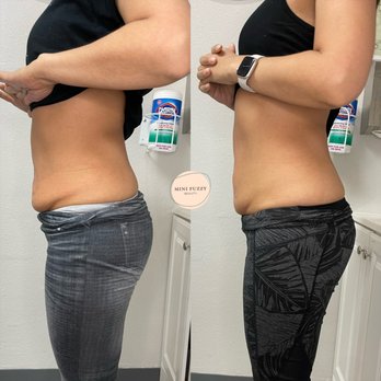 Mini Fuzzy Beauty - Result after just 2 sessions - Permanent Makeup Near Me Mini Fuzzy Beauty - Result after just 2 sessions - Permanent Makeup Near Me