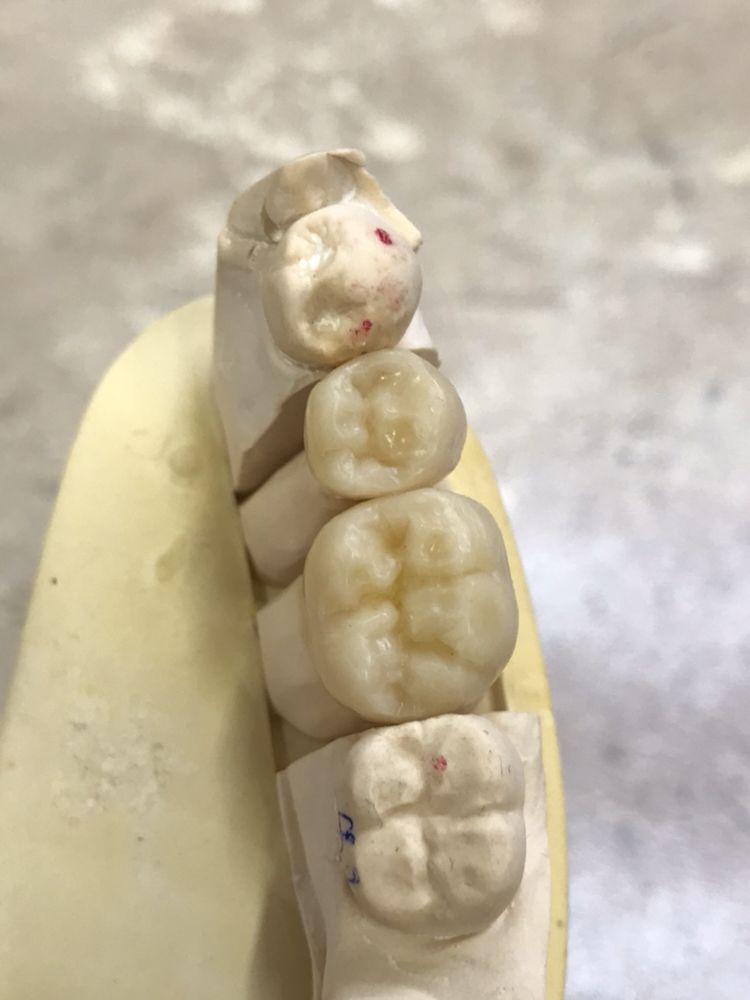 EXPRESS DENTAL LABORATORY Updated August 2024 21 Photos 125 E