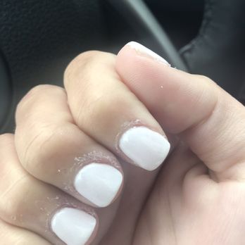 Nailed It Spa - Botched cuticles. - Nail Salons Near Me - Fort Wayne, Indiana