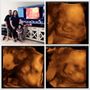 Photo of Babyvue 3D/4D ultrasound
