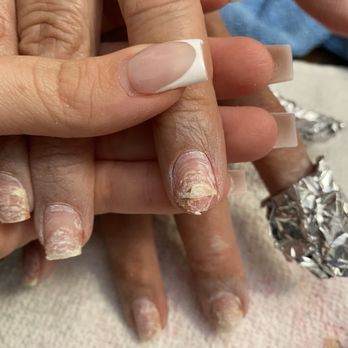 Circle A Nails And Spa - My mom's nail on her ring finger is half way gone! This is from me trying to soak off the acrylic. We did not rip these nails off. - Nail Salons Near Me - Redlands, California