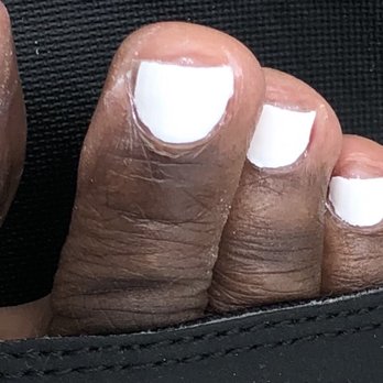 You Got Nail - Toenails uneven cut to the meat - Hair Salons Near Me - Alexandria, Virginia You Got Nail - Toenails uneven cut to the meat - Hair Salons Near Me - Alexandria, Virginia
