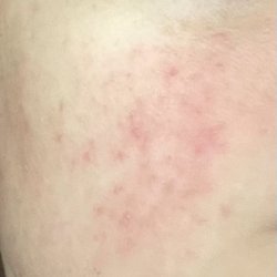 Macaione & Papa Dermatology - Before