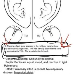 Campbell Ear Nose & Throat - I had to go to urgent care (after work because I could not afford to miss any more days)