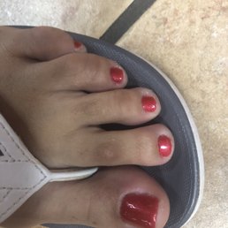 Bad pedicure. Zoom in Bad pedicure. Zoom in