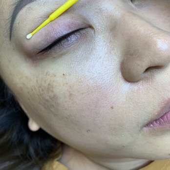 Enhanced Permanent MakeUp - Right after my eyeliner enhanced by Tiffany - Permanent Makeup Near Me - Long Beach, California Enhanced Permanent MakeUp - Right after my eyeliner enhanced by Tiffany - Permanent Makeup Near Me - Long Beach, California