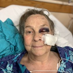 Lam Family Medicine - 9/24/24 I fell on face, over 36 stitches, Lam refused to see me ~ cuz I told him his patient toilet seat/&dirty toilet. "Acceptable" he said