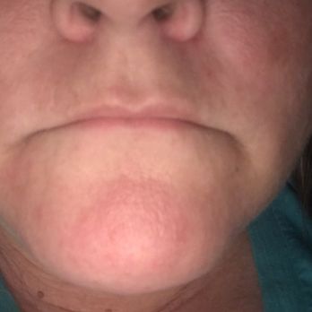 Iconic Plastic Surgery - Cosmetic Surgeons Near Me - Carlsbad, California Iconic Plastic Surgery - Cosmetic Surgeons Near Me - Carlsbad, California