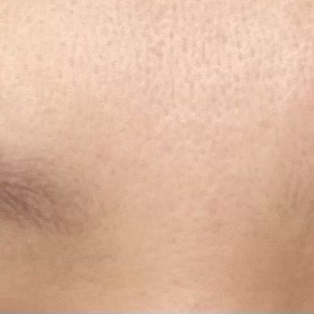 Esthetically Linh - Before (semi-ombré tattoo from 2 years ago) - Sugaring Near Me - Orange, California Esthetically Linh - Before (semi-ombré tattoo from 2 years ago) - Sugaring Near Me - Orange, California