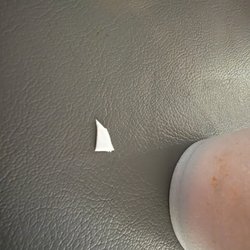 The piece of plastic I bit into.