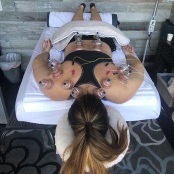Balance Point Therapy - Acupuncture Near Me - Costa Mesa, California
