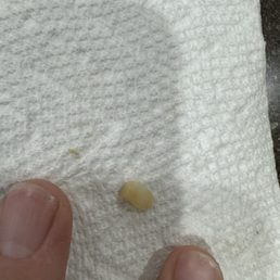 Finger nail Finger nail