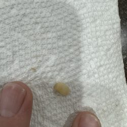 Cafe De Manuel - Finger nail