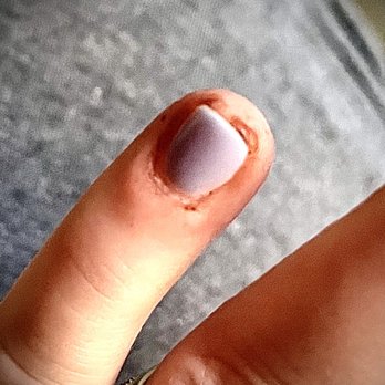 Red Nails - 6 days post. This was by far the worst. - Nail Salons Near Me - Saint Paul, Minnesota Red Nails - 6 days post. This was by far the worst. - Nail Salons Near Me - Saint Paul, Minnesota