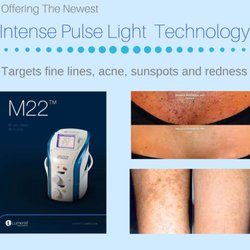 Westlake Laser and Aesthetics