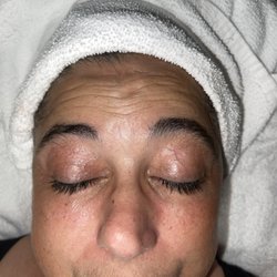 Inner Glow Esthetics - Before Eyebrow wax