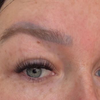 Tiger's Eye Brow Studio - Before laser removal--7 year old botched brows - Permanent Makeup Near Me - Denver, Colorado