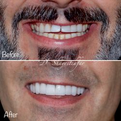 Mojdeh Shayestehfar, DDS - Linden Dental Care - Full Mouth Rehabilitation!