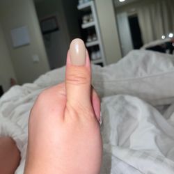 Fingers and Toes - This nail is a completely different length and shape than my right thumb