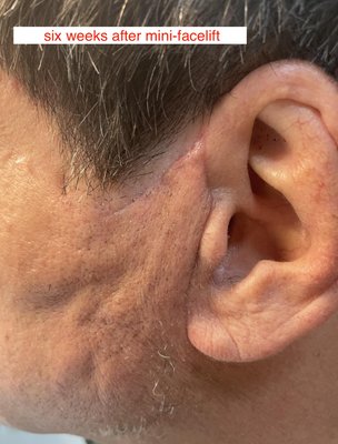 Baroody Plastic Surgery by null