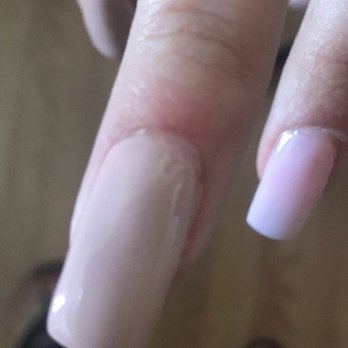 Focus Nails - More skin agitated sure to bad cuticle job - Nail Salons Near Me - El Cajon, California Focus Nails - More skin agitated sure to bad cuticle job - Nail Salons Near Me - El Cajon, California