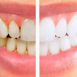 Village Dental
