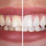 Photo of De Zavala Dental