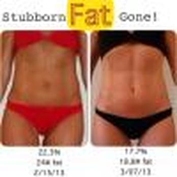 CL Trule - Got rid of stubborn body fat and toned up without restrictions, supplements or medications. - Trainers Near Me - Frisco, Texas CL Trule - Got rid of stubborn body fat and toned up without restrictions, supplements or medications. - Trainers Near Me - Frisco, Texas