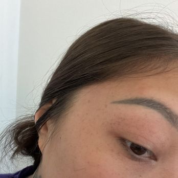 Sushi REV - woke up with popped blood vessels on both sides of my face from throwing up this food poisoning - Sushi Bars Near Me - Irvine, California Sushi REV - woke up with popped blood vessels on both sides of my face from throwing up this food poisoning - Sushi Bars Near Me - Irvine, California