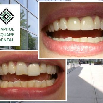 Capitol Square Dental - General Dentistry Near Me - Madison, Wisconsin