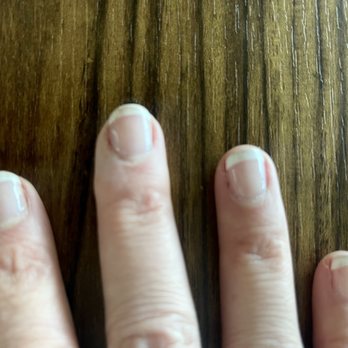 Nail Day Lodo - Permanently stained (Poor Quality) French Gel Manicure from eating nuts! - Nail Salons Near Me - Denver, Colorado Nail Day Lodo - Permanently stained (Poor Quality) French Gel Manicure from eating nuts! - Nail Salons Near Me - Denver, Colorado