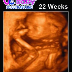 UC Baby - 3D Ultrasound