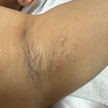 Eye Candy - Result after 6 treatments - Eyelash Service Near Me - Buena Park, California Eye Candy - Result after 6 treatments - Eyelash Service Near Me - Buena Park, California