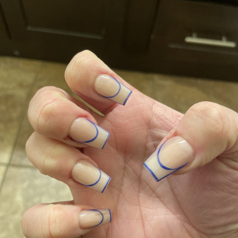 Pop Nails - What I got you can see the redness on both sides of my middle finger where the infection began - Nail Salons Near Me - Modesto, California Pop Nails - What I got you can see the redness on both sides of my middle finger where the infection began - Nail Salons Near Me - Modesto, California