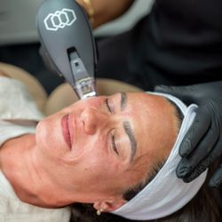 Enova MedSpa - Morpheus 8
Treatment