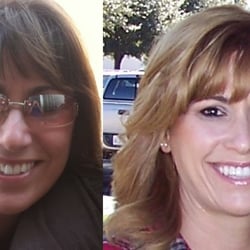 Lakeshore Cosmetic Dentistry - Before and after treament with Dr. Ameri. June 2012 before photo / Nov 2014 after photo.