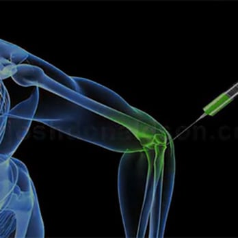Josh Donaldson, ND - Prolotherapy as Alternative Medicine - Naturopathic/Holistic Near Me - Los Gatos, California Josh Donaldson, ND - Prolotherapy as Alternative Medicine - Naturopathic/Holistic Near Me - Los Gatos, California
